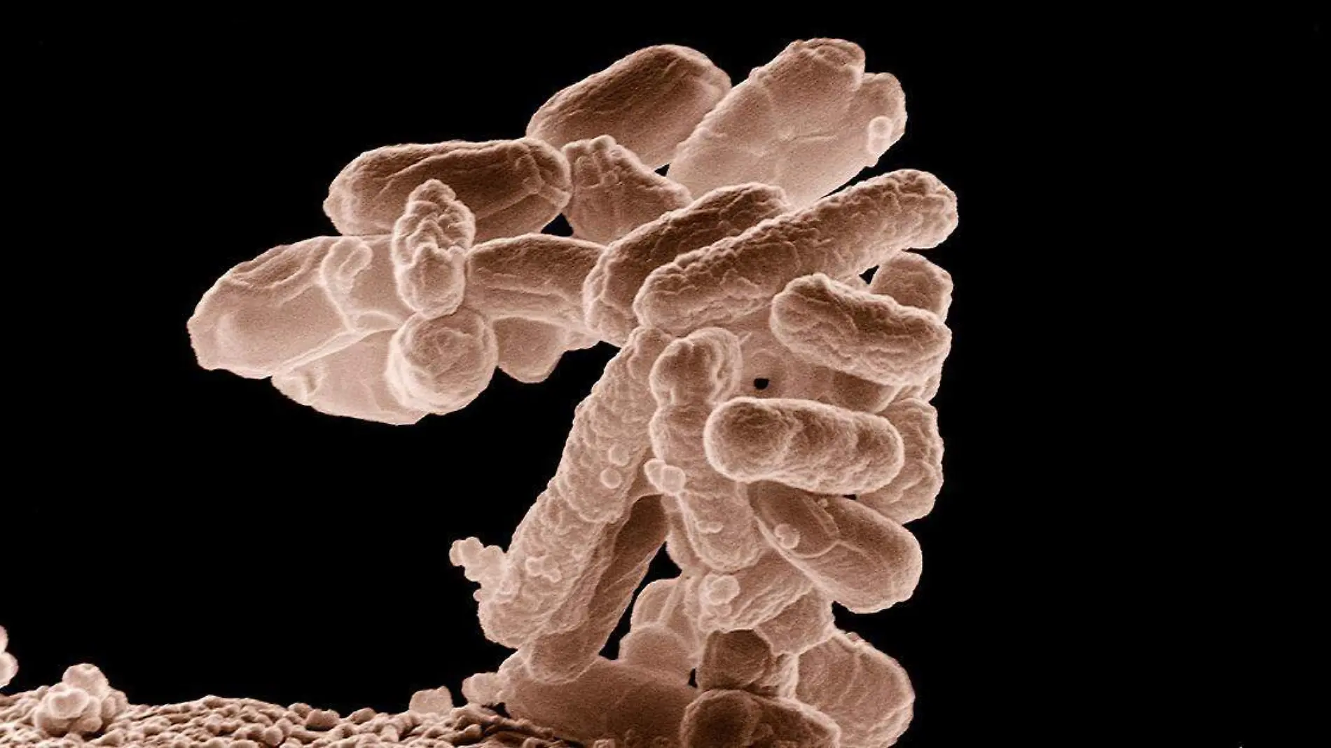 Un grupo de científicos recientemente descubrió un tipo de superbacterias que son capaces de resistir a los antibióticos